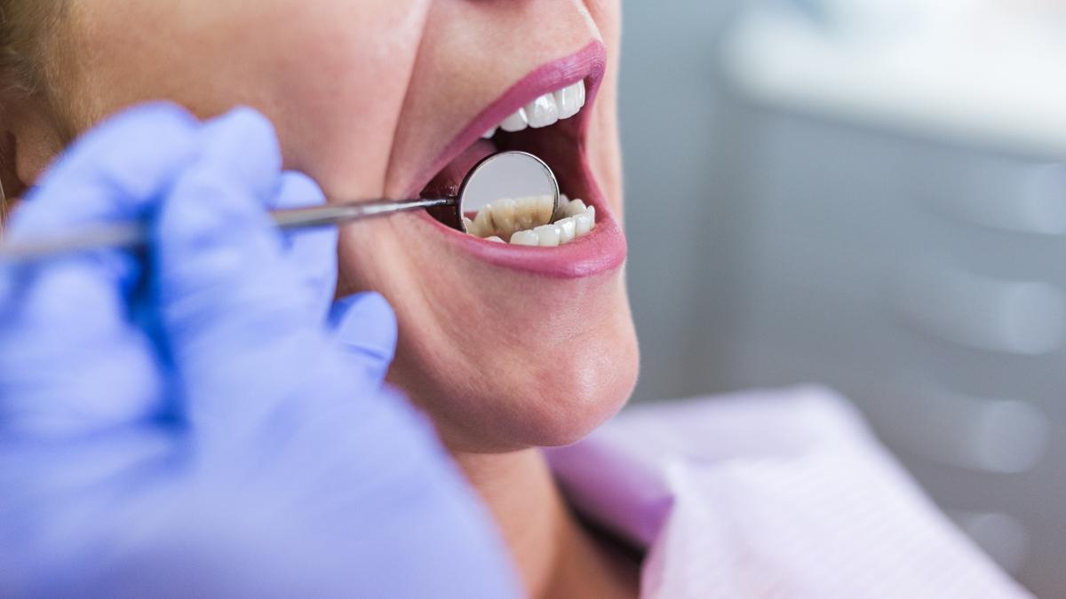 Close-up of a mouth in the dental chair