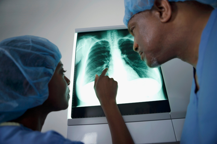 Two doctors looking at lung xray