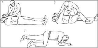 A diagram demonstrating how to place someone in the recovery position.
