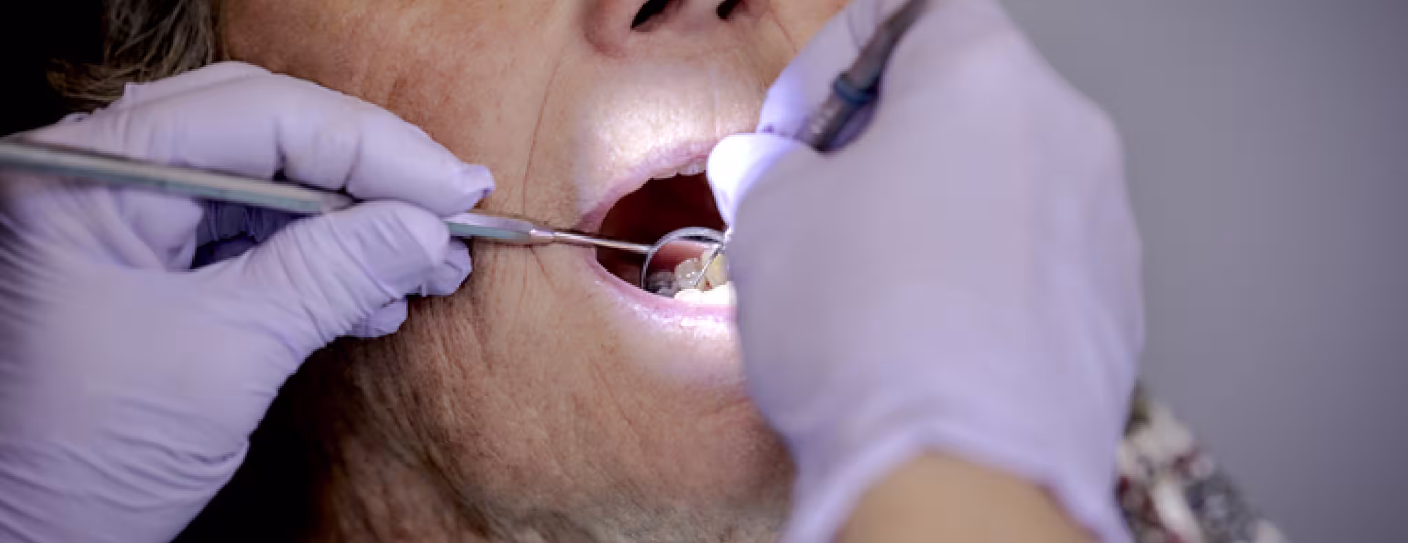 Senior at the dentist