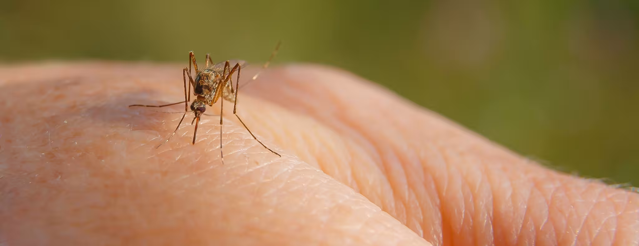 A hand with a mosquito on it