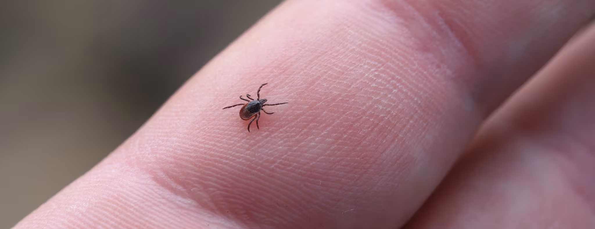 female blacklegged tick on a person's hand